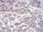 EZH2 Antibody